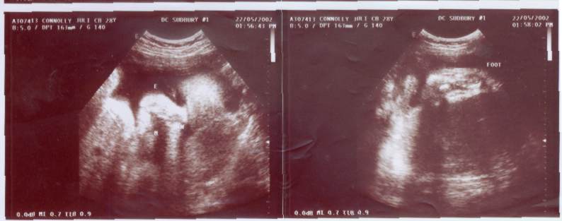 ultrasound.jpg